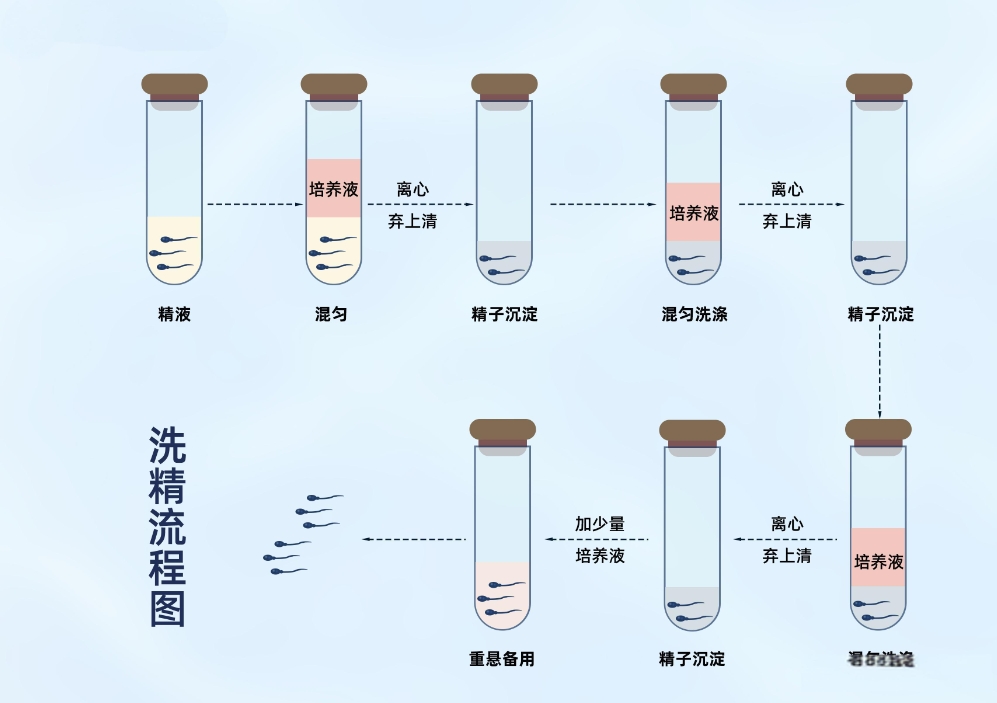 柬埔寨HIV洗精术做试管婴儿费用要多少